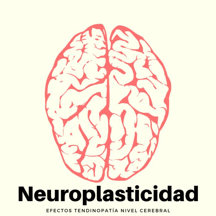 Neuroplasticidad y Tendinopatía